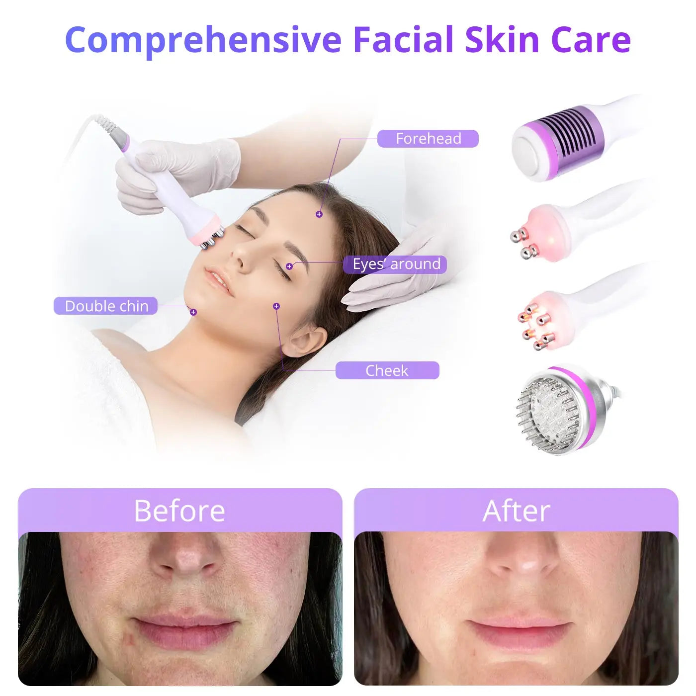 Mychway Cavitation 40k Machine Skin Tightening 9 In 1 Tool